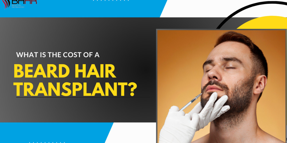 Breaking Down Hair Transplant Costs in California